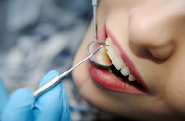Dentysta sprawdzajacy uzębienie